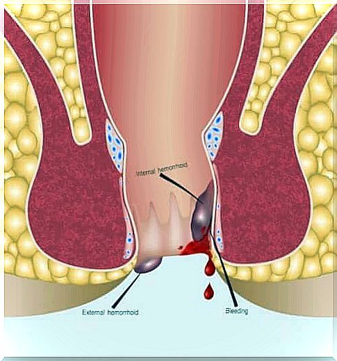 Anoscopy: when it is indicated for a patient