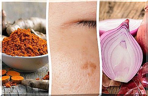 Do you have skin blemishes?  These 6 home remedies will help to reduce them