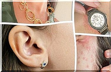 How to treat jewelry allergy?