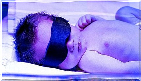 baby with jaundice