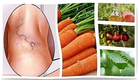 Treatment of varicose veins with aloe vera, carrots and apple cider vinegar