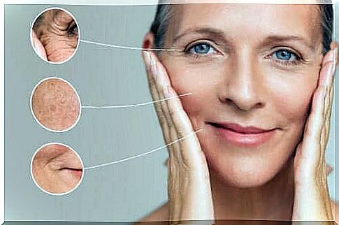 What are the different types of wrinkles?