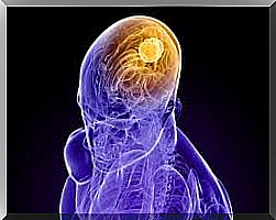 Origin and characteristics of glioma